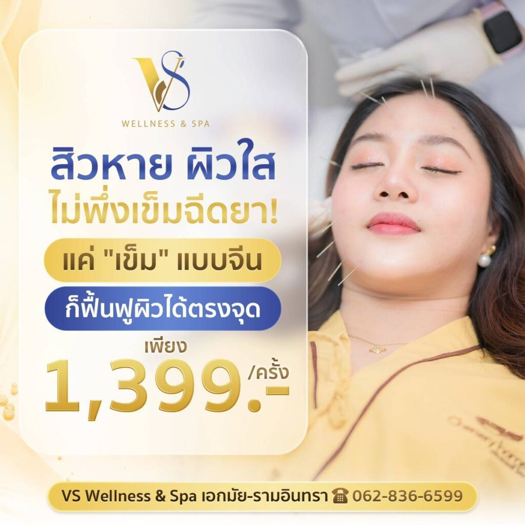 สิวหายผิวใส เข็มจีน